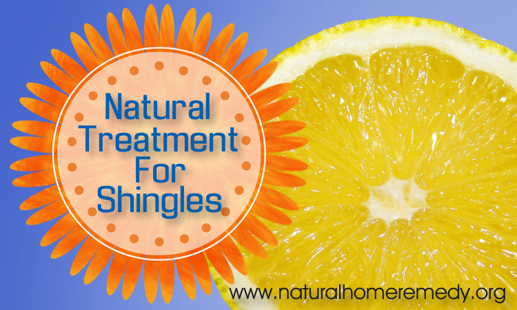Natural Treatment For Shingles Get Relief Today Best All Natural