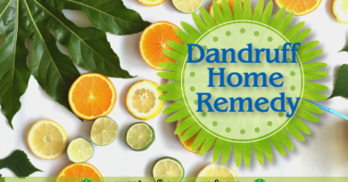 dandruff home remedies